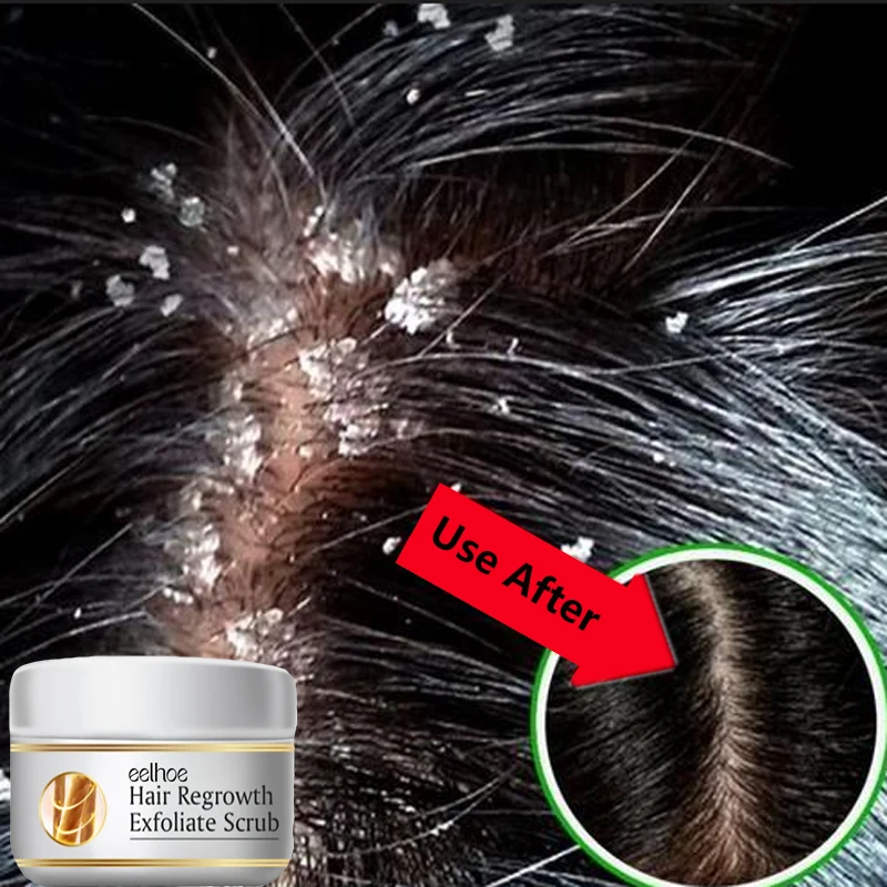 Perawatan Rambut Anti Ketombe  - Scalp Scrub Exfoliant ulasan dan harga