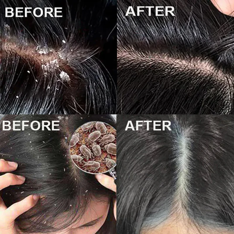 Perawatan Rambut Anti Ketombe  - Scalp Scrub Exfoliant ulasan dan harga