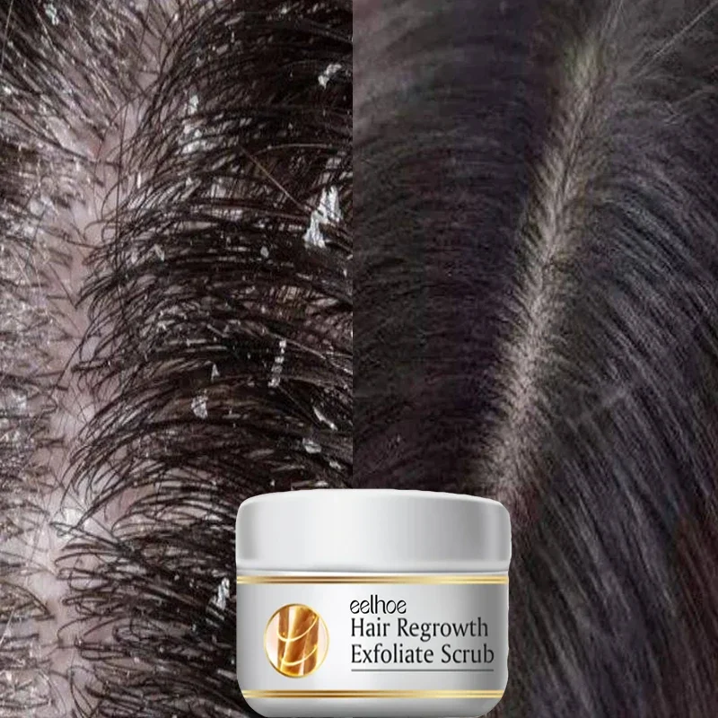Perawatan Rambut Anti Ketombe  - Scalp Scrub Exfoliant ulasan dan harga