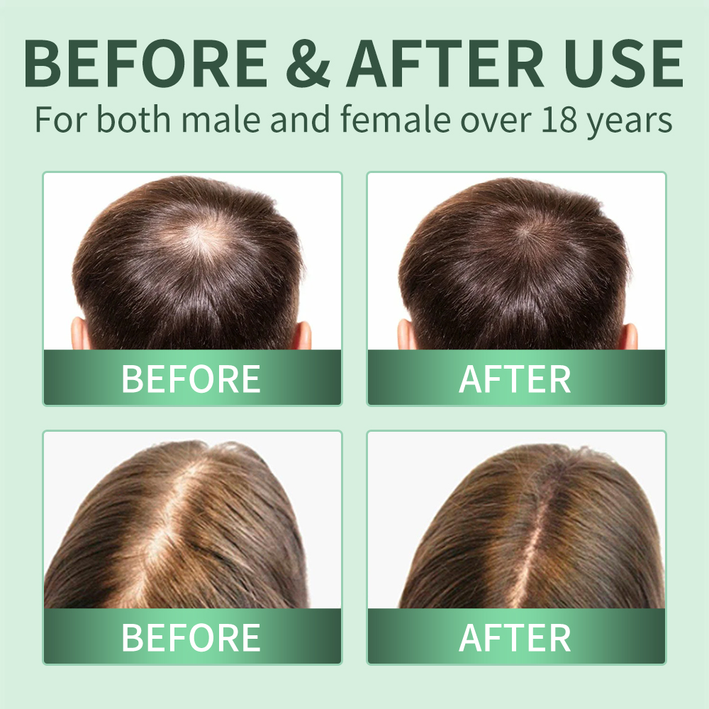 Semprotan Penumbuh Rambut, Scr - Scalp Scrub Exfoliant ulasan dan harga
