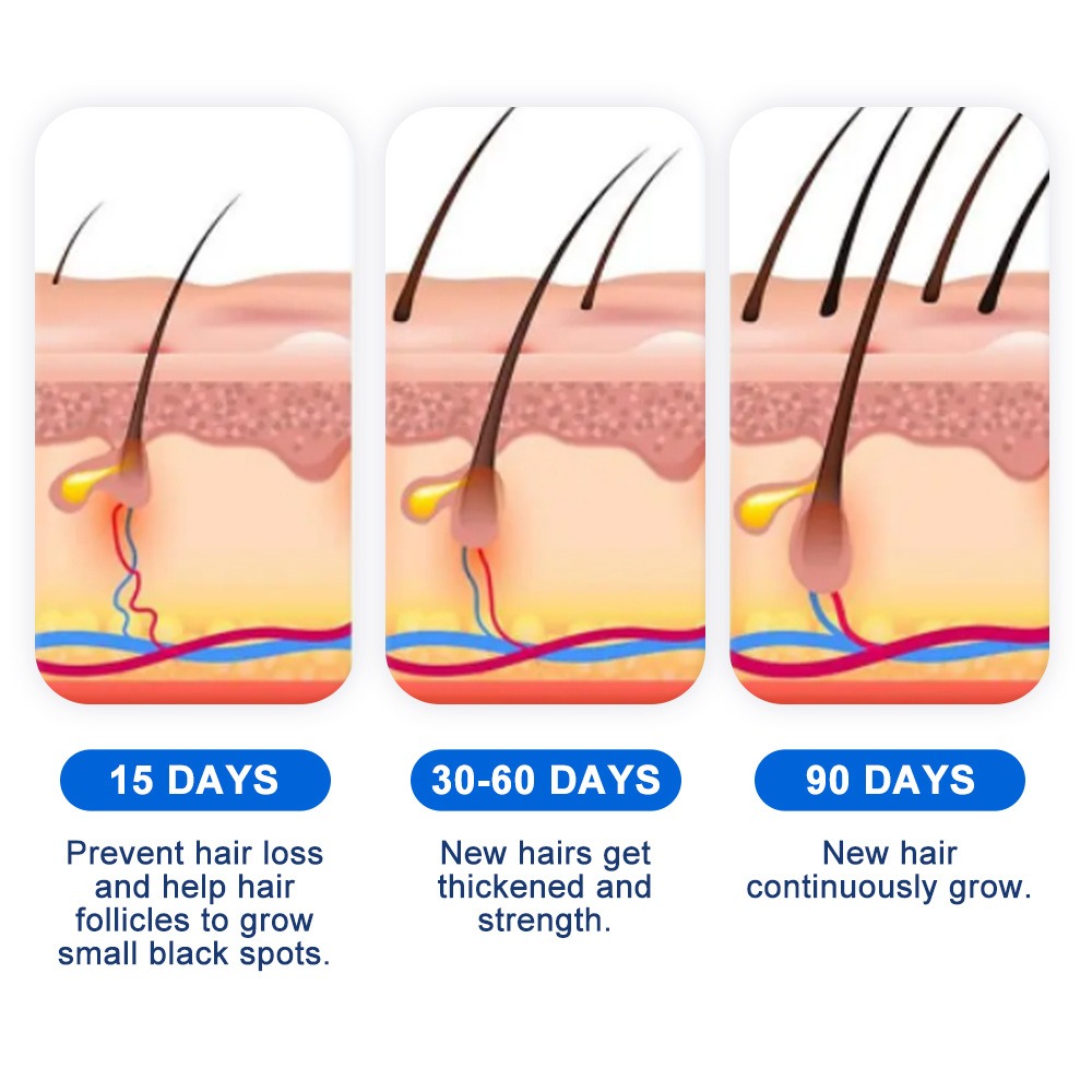 Semprotan Penumbuh Rambut Alop - Hair Care For Hair Growth ulasan dan harga