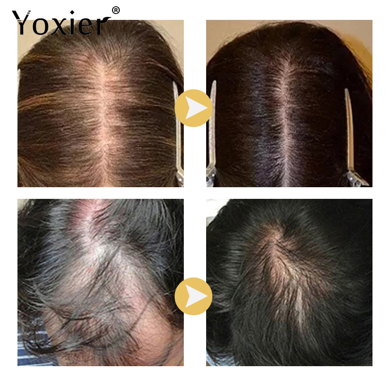 Serum Pertumbuhan Intensif Men - Hair Care For Hair Growth ulasan dan harga