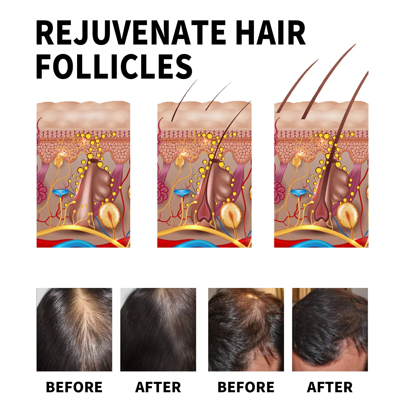 Produk Penumbuh Rambut Jahe Mi - Hair Care For Dry And Frizzy Hair ulasan dan harga