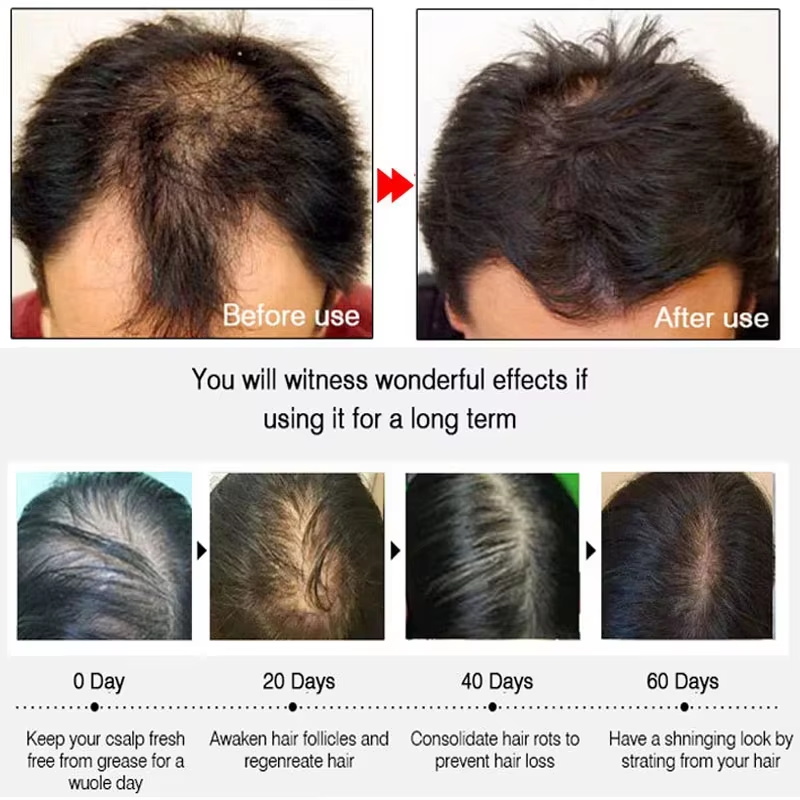 Semprotan Penumbuh Rambut Jahe - Hair Care For Hair Growth ulasan dan harga