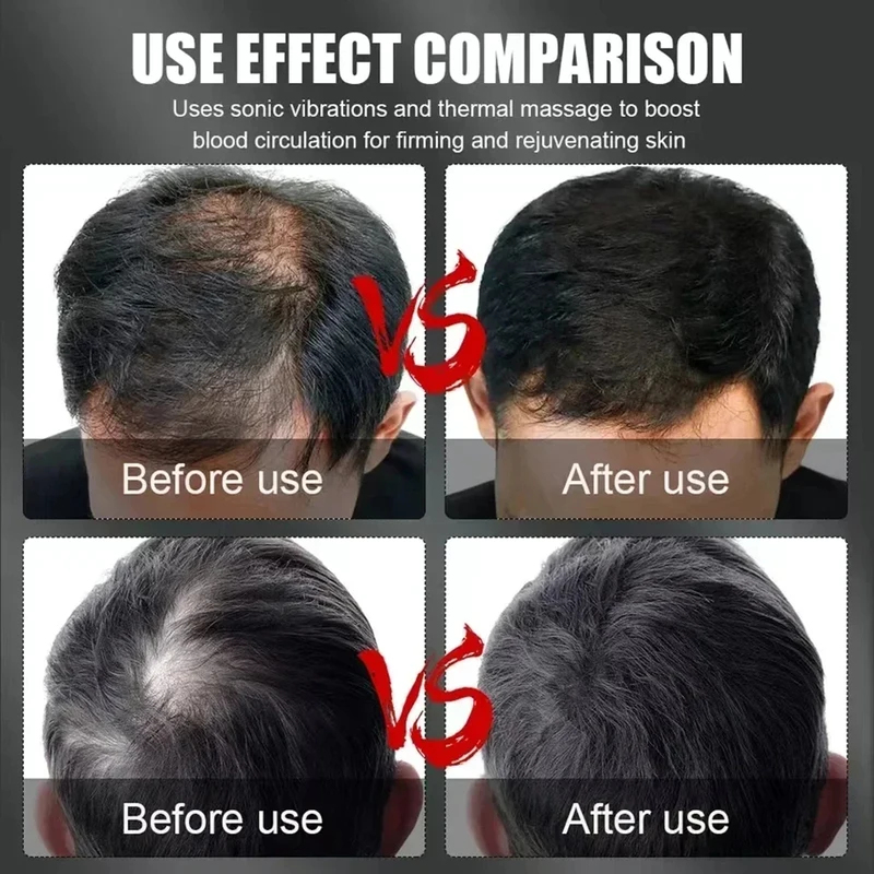 Topi Terapi Rambut Cahaya Mera - Hair Care For Hair Growth ulasan dan harga